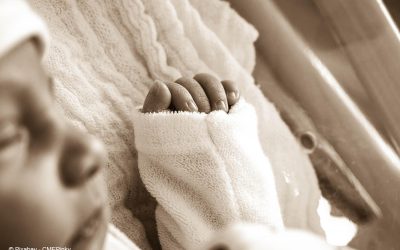 Gelbsucht bei Neugeborenen: Neue Methode zur Früherkennung